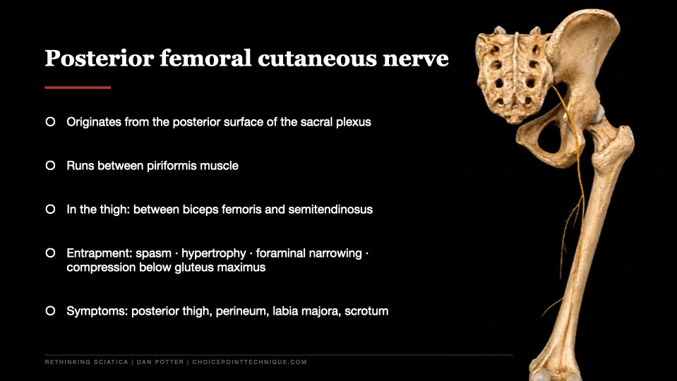 Slide 17 of 27